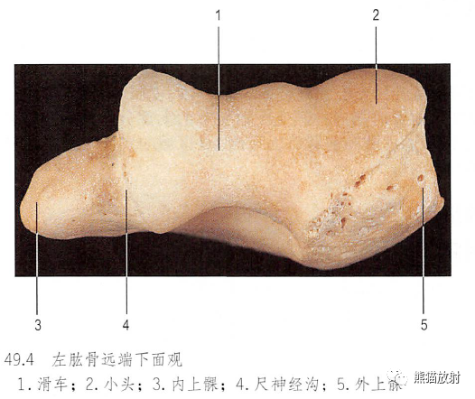 影像PPT - 肩及上肢解剖(上/前臂、手、肘/腕)-29 影像PPT - 肩及上肢解剖(上/前臂、手、肘/腕)-29