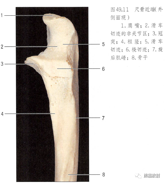 影像PPT - 肩及上肢解剖(上/前臂、手、肘/腕)-32 影像PPT - 肩及上肢解剖(上/前臂、手、肘/腕)-32