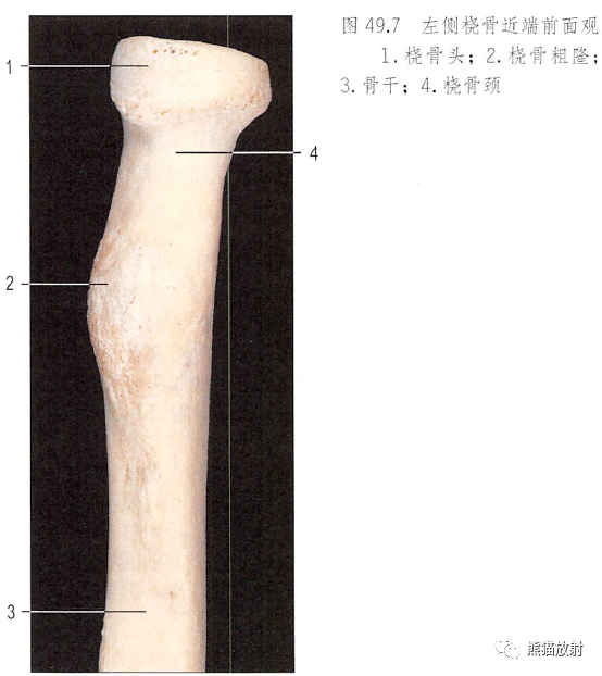 影像PPT - 肩及上肢解剖(上/前臂、手、肘/腕)-30 影像PPT - 肩及上肢解剖(上/前臂、手、肘/腕)-30