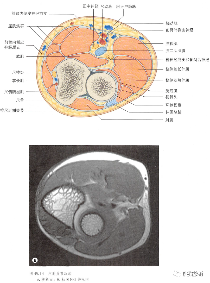 影像PPT - 肩及上肢解剖(上/前臂、手、肘/腕)-35 影像PPT - 肩及上肢解剖(上/前臂、手、肘/腕)-35