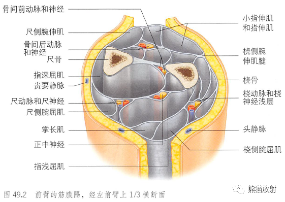 影像PPT - 肩及上肢解剖(上/前臂、手、肘/腕)-27 影像PPT - 肩及上肢解剖(上/前臂、手、肘/腕)-27
