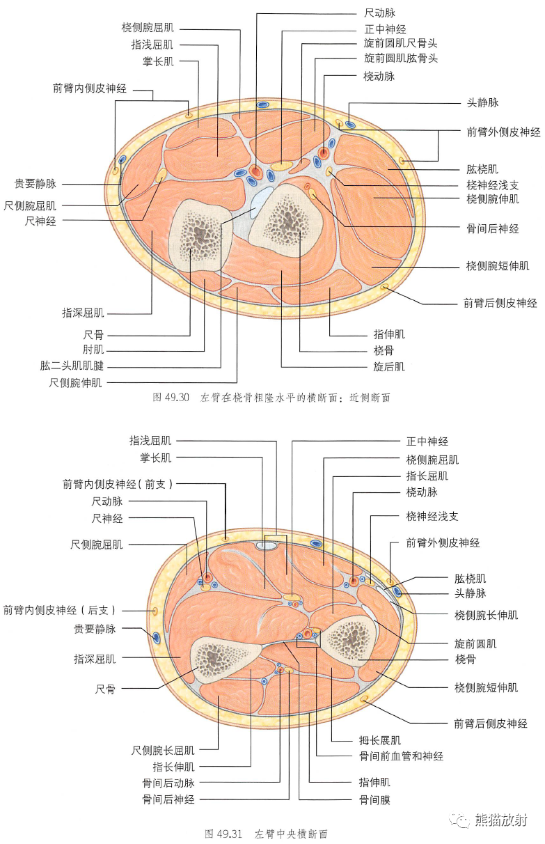 影像PPT - 肩及上肢解剖(上/前臂、手、肘/腕)-39 影像PPT - 肩及上肢解剖(上/前臂、手、肘/腕)-39