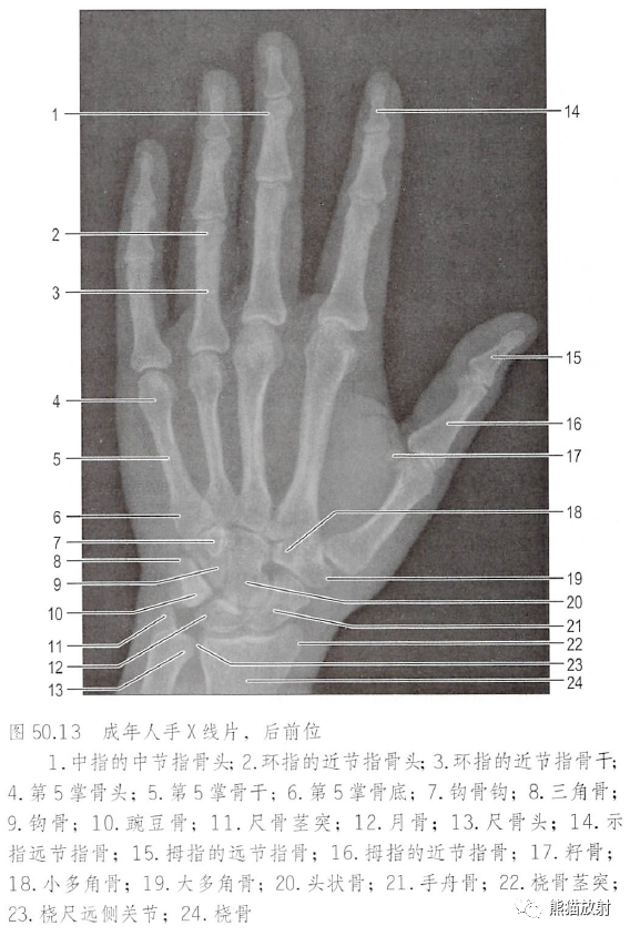 影像PPT - 肩及上肢解剖(上/前臂、手、肘/腕)-43 影像PPT - 肩及上肢解剖(上/前臂、手、肘/腕)-43