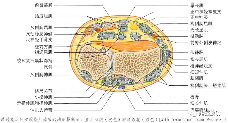 影像PPT - 肩及上肢解剖(上/前臂、手、肘/腕)-47 影像PPT - 肩及上肢解剖(上/前臂、手、肘/腕)-47