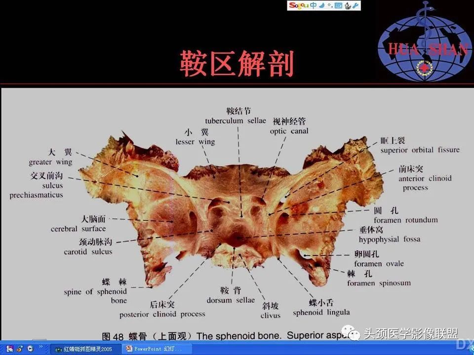影像PPT - 【PPT】鞍区病变影像诊断-2