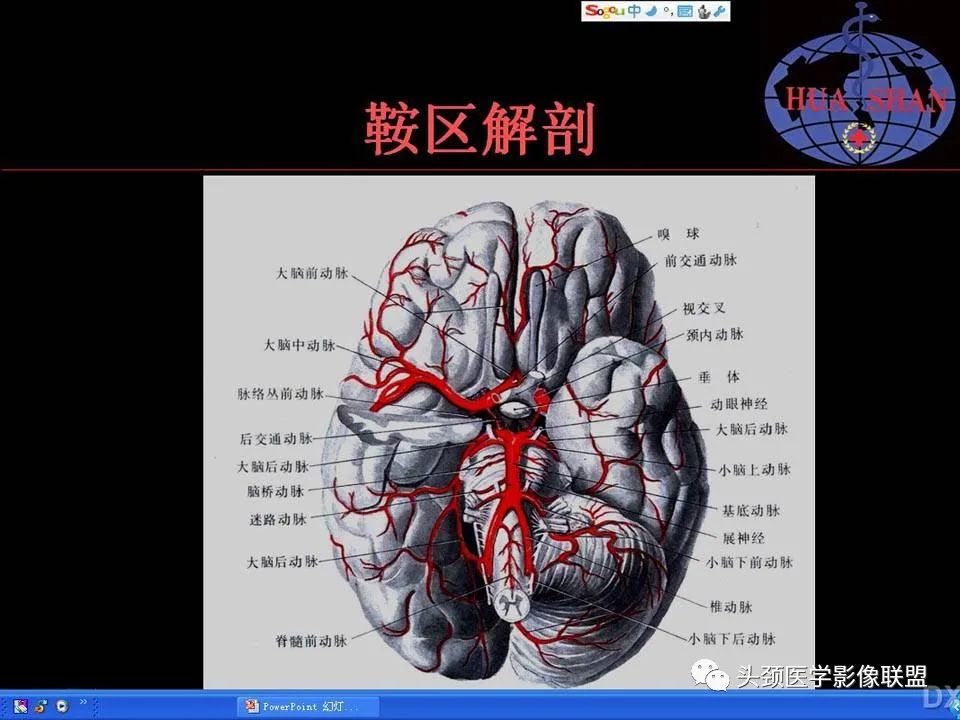 影像PPT - 【PPT】鞍区病变影像诊断-5