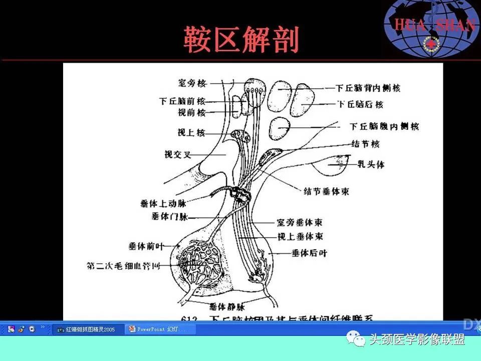 影像PPT - 【PPT】鞍区病变影像诊断-3