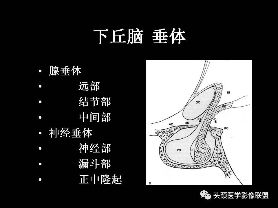 影像PPT - 【PPT】鞍区病变影像诊断-9