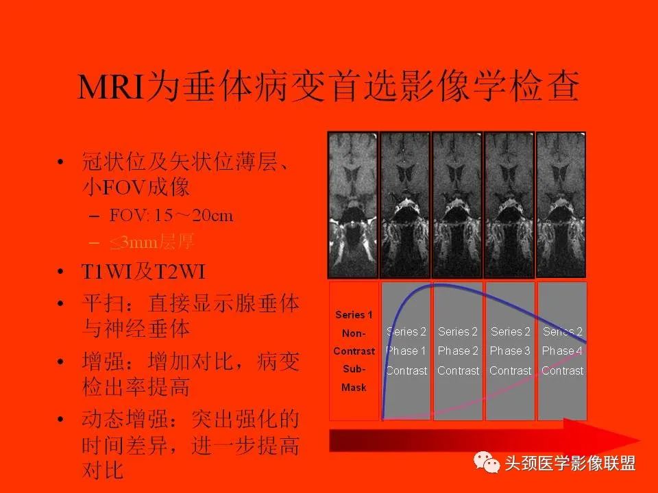 影像PPT - 【PPT】鞍区病变影像诊断-24