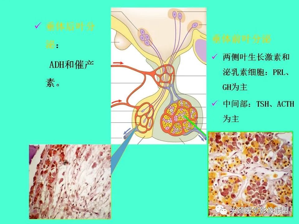 影像PPT - 【PPT】鞍区病变影像诊断-28