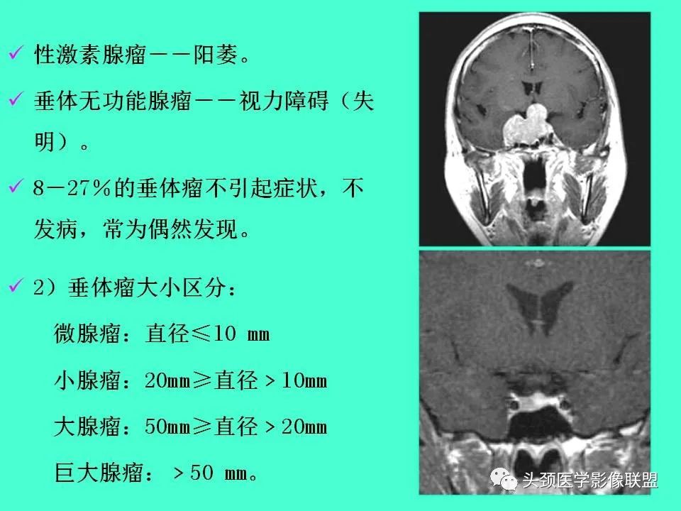 影像PPT - 【PPT】鞍区病变影像诊断-36