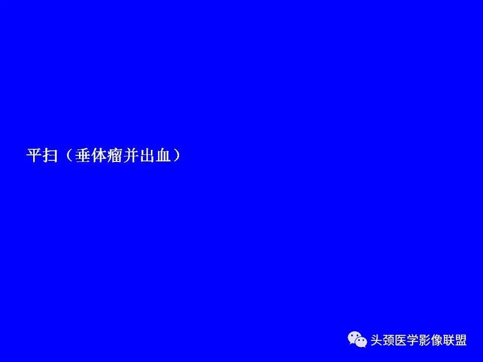 影像PPT - 【PPT】鞍区病变影像诊断-67