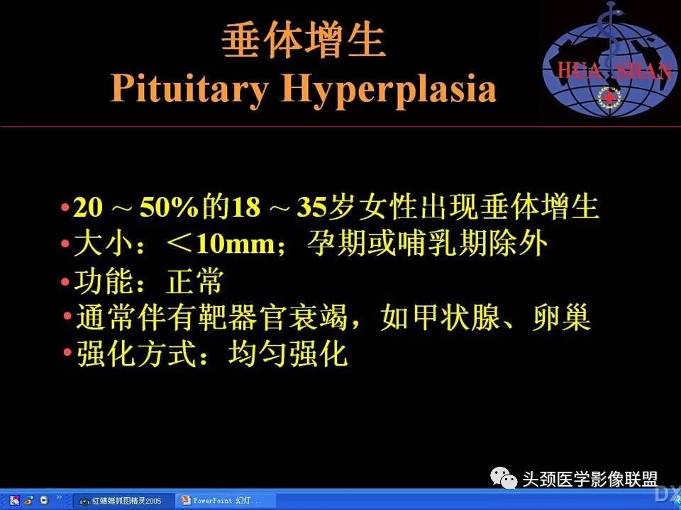 影像PPT - 【PPT】鞍区病变影像诊断-99