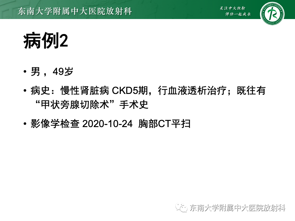 影像PPT - 【PPT】肺泡微石症-21