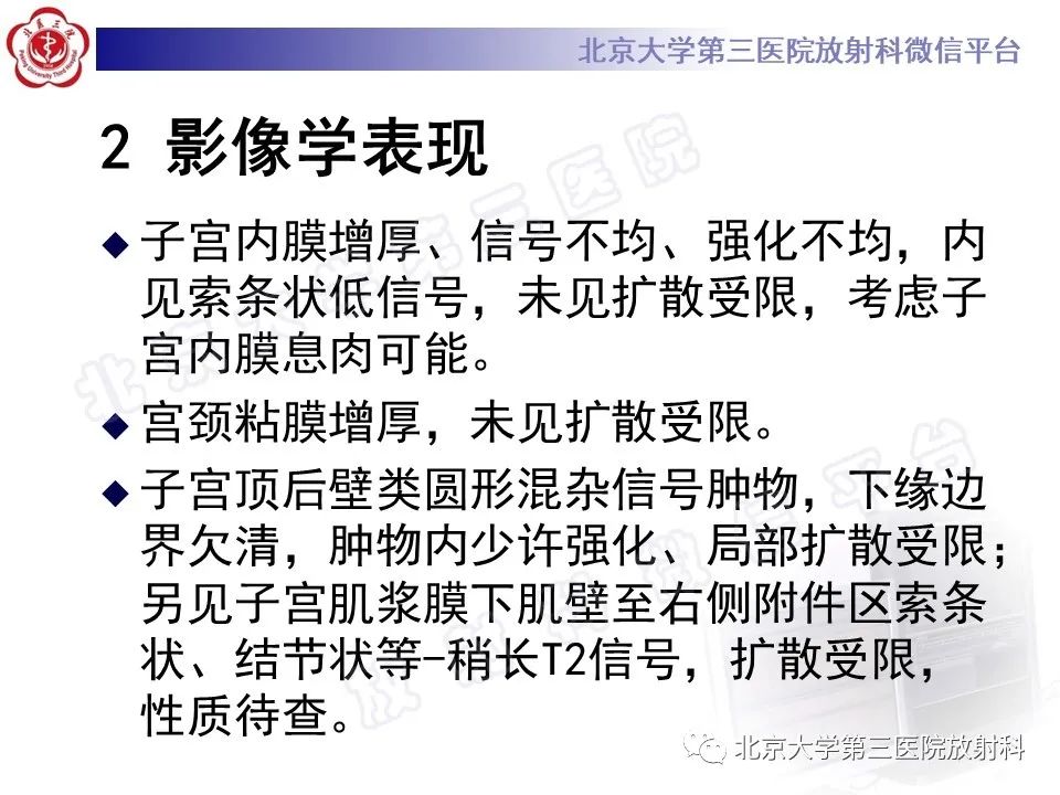 影像PPT - 【PPT】子宫内膜间质肉瘤-6