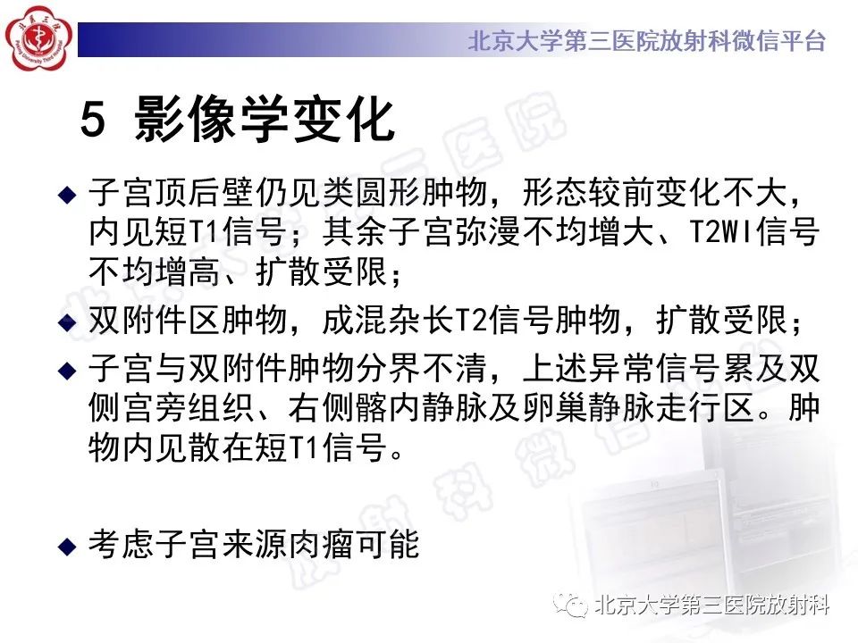 影像PPT - 【PPT】子宫内膜间质肉瘤-13