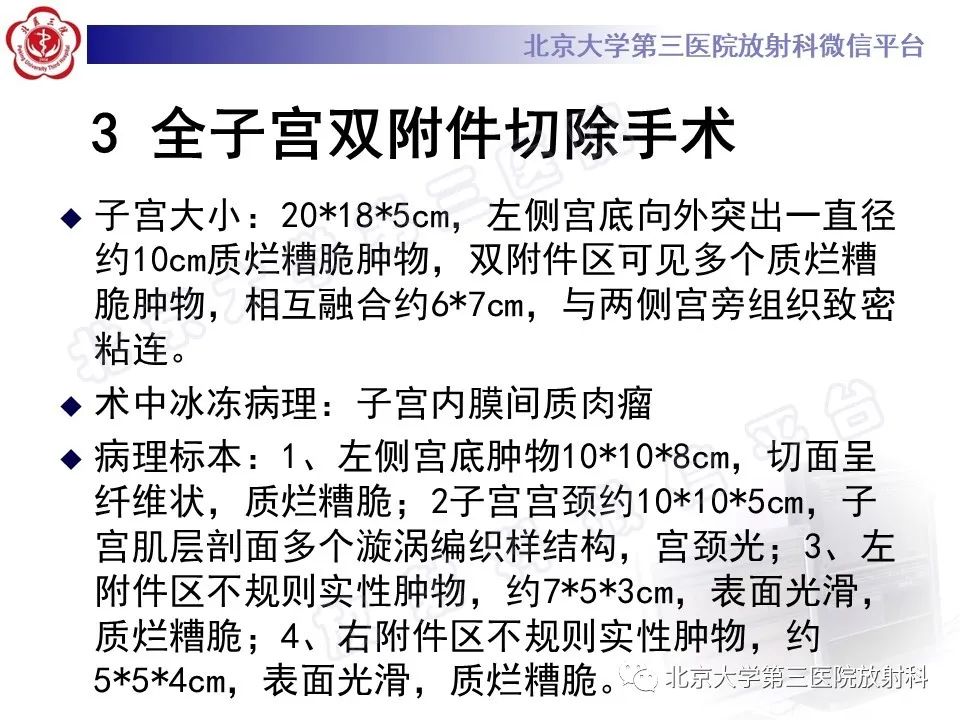影像PPT - 【PPT】子宫内膜间质肉瘤-14