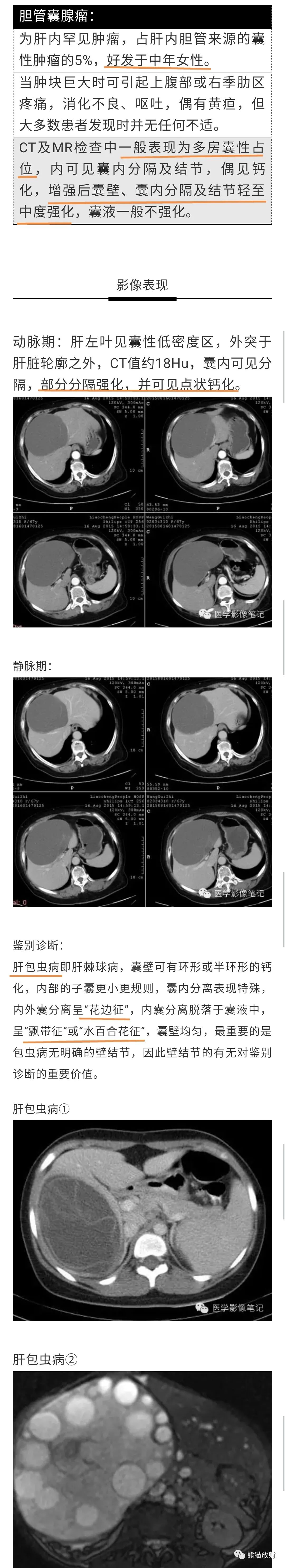 影像PPT - 【病例】胆管囊腺瘤1例CT及MR-7 影像PPT - 【病例】胆管囊腺瘤1例CT及MR-7