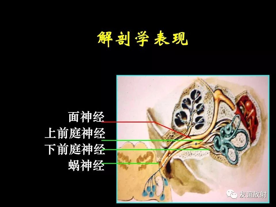 影像PPT - 【PPT】面听神经的MRI-5