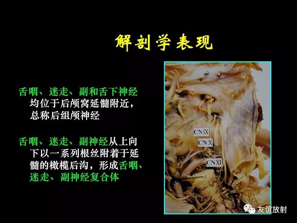 影像PPT - 【PPT】面听神经的MRI-23