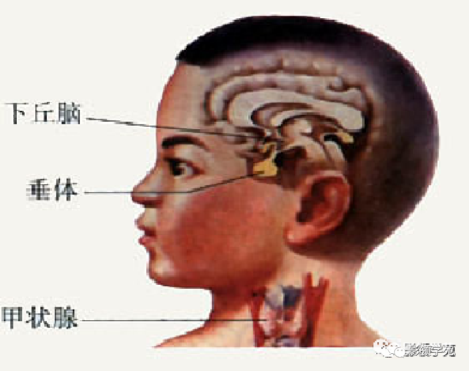 影像PPT - 【PPT】垂体解剖及常见病变影像学表现-2 影像PPT - 【PPT】垂体解剖及常见病变影像学表现-2