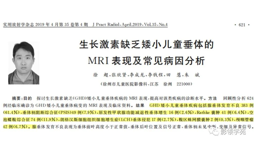 影像PPT - 【PPT】垂体解剖及常见病变影像学表现-18 影像PPT - 【PPT】垂体解剖及常见病变影像学表现-18