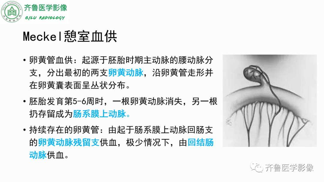 影像PPT - 【PPT】消化道憩室-14