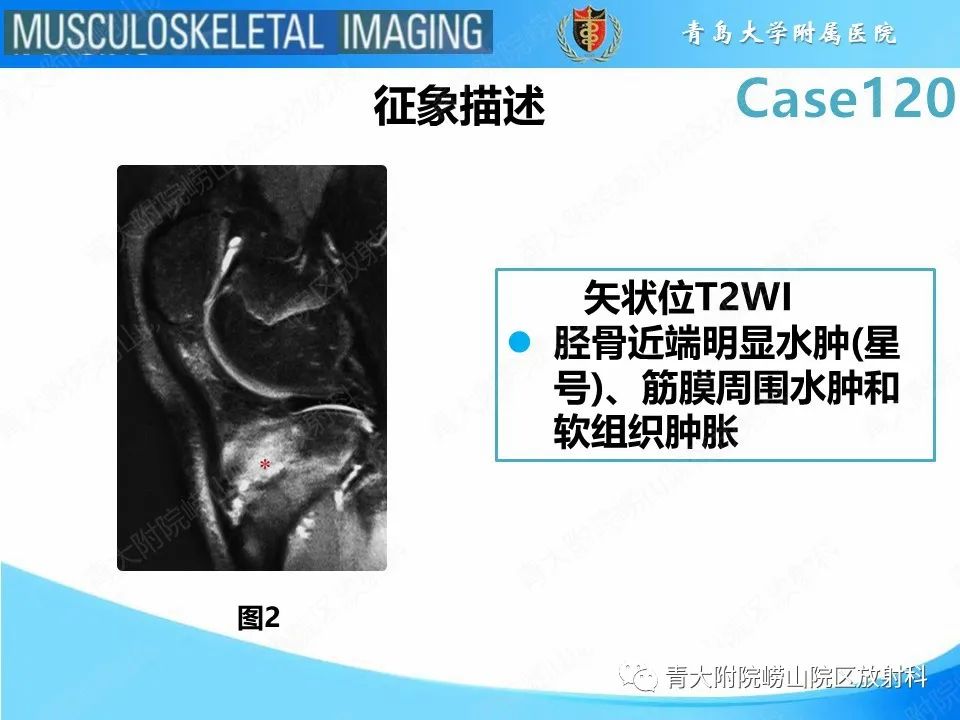 影像PPT - 【PPT】Osgood-Schlatter病-12