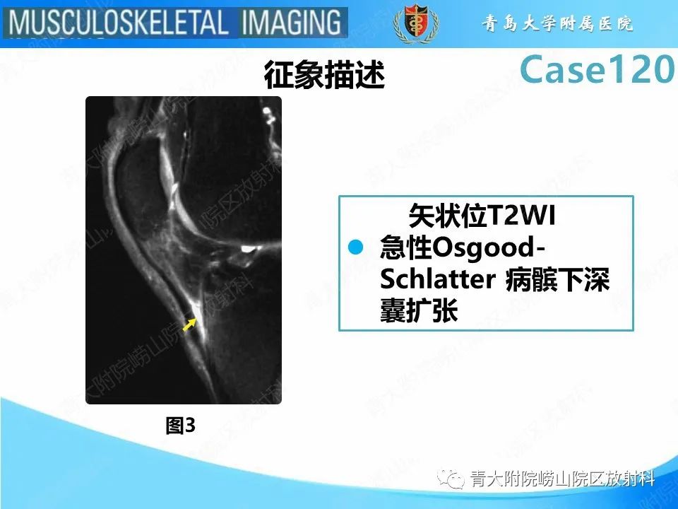 影像PPT - 【PPT】Osgood-Schlatter病-13