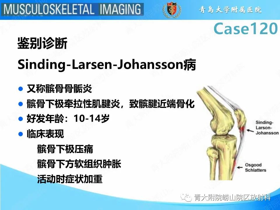 影像PPT - 【PPT】Osgood-Schlatter病-22
