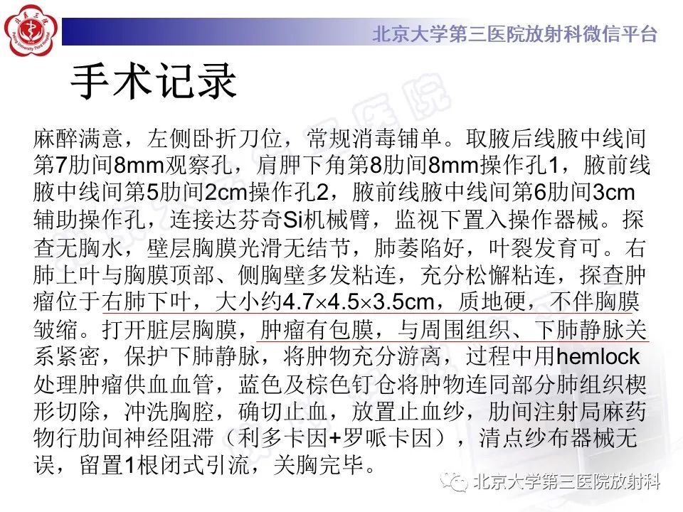 影像PPT - 【PPT】硬化性肺泡细胞瘤-8
