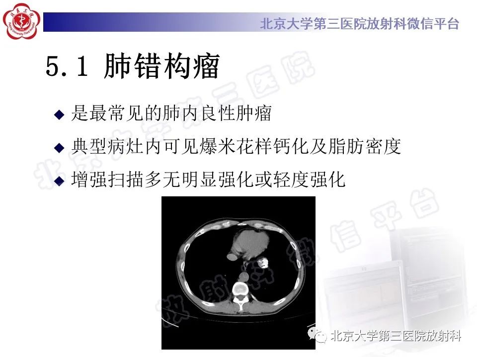 影像PPT - 【PPT】硬化性肺泡细胞瘤-19