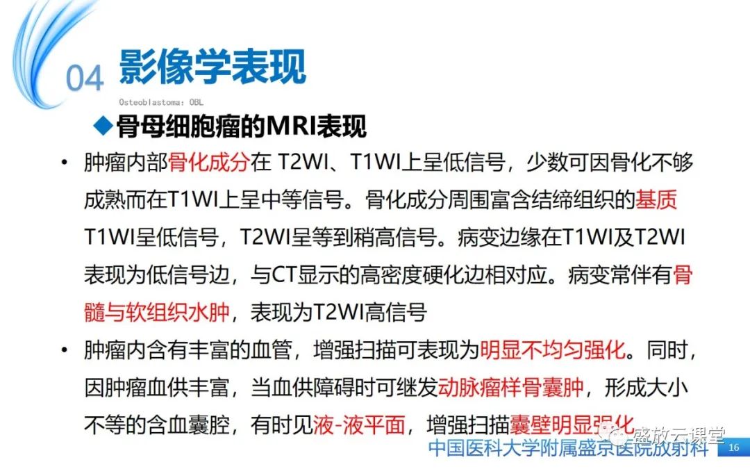 影像PPT - 【PPT】骨母细胞瘤-16