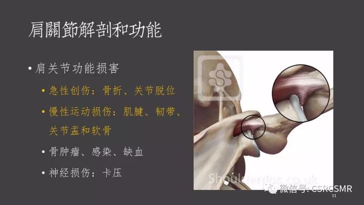 影像PPT - 【PPT】肩关节MRI的结构式评估-11