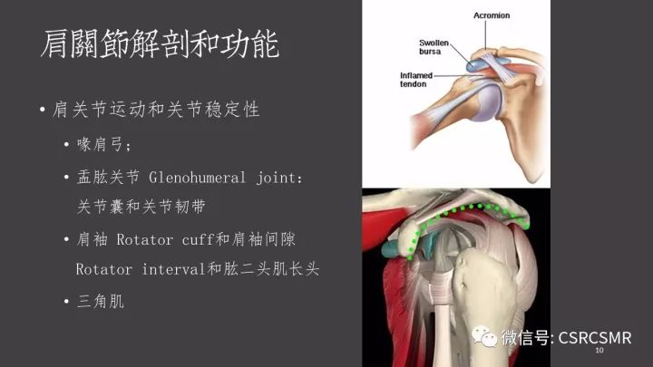 影像PPT - 【PPT】肩关节MRI的结构式评估-10