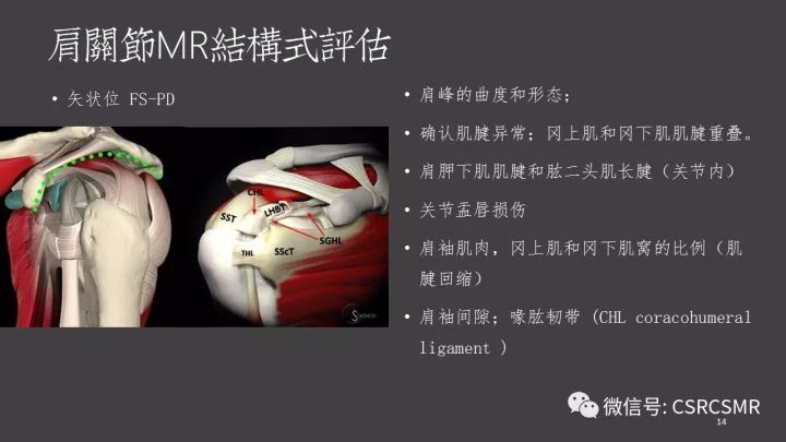 影像PPT - 【PPT】肩关节MRI的结构式评估-14
