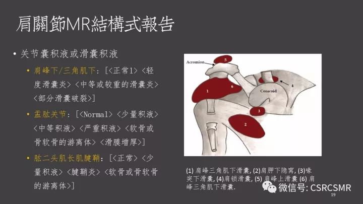 影像PPT - 【PPT】肩关节MRI的结构式评估-19