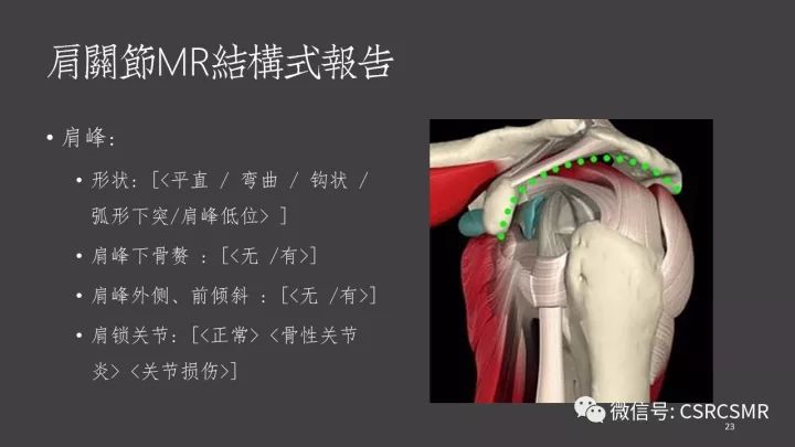 影像PPT - 【PPT】肩关节MRI的结构式评估-23