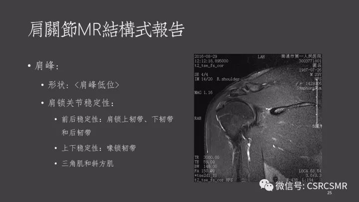 影像PPT - 【PPT】肩关节MRI的结构式评估-25