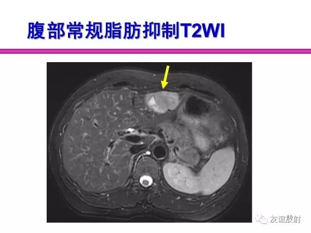 影像PPT - 【PPT】腹部脏器影像解剖及CT、MRI读片原则-10