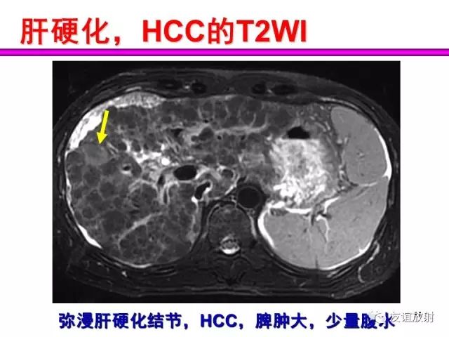 影像PPT - 【PPT】腹部脏器影像解剖及CT、MRI读片原则-11
