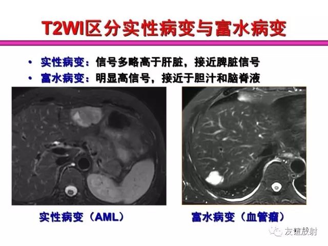 影像PPT - 【PPT】腹部脏器影像解剖及CT、MRI读片原则-12