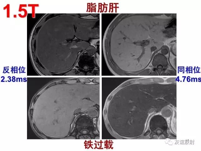 影像PPT - 【PPT】腹部脏器影像解剖及CT、MRI读片原则-15
