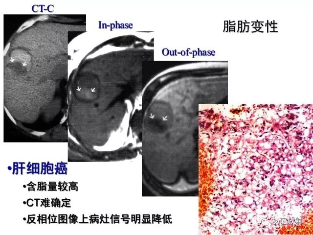 影像PPT - 【PPT】腹部脏器影像解剖及CT、MRI读片原则-17