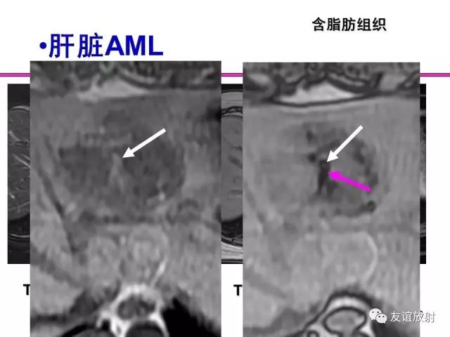 影像PPT - 【PPT】腹部脏器影像解剖及CT、MRI读片原则-16