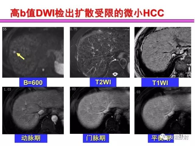 影像PPT - 【PPT】腹部脏器影像解剖及CT、MRI读片原则-21