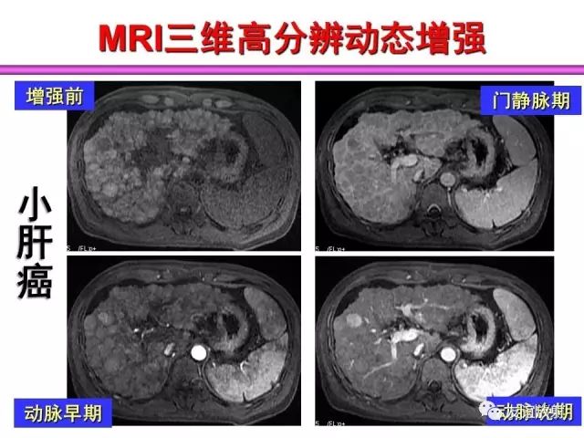 影像PPT - 【PPT】腹部脏器影像解剖及CT、MRI读片原则-23