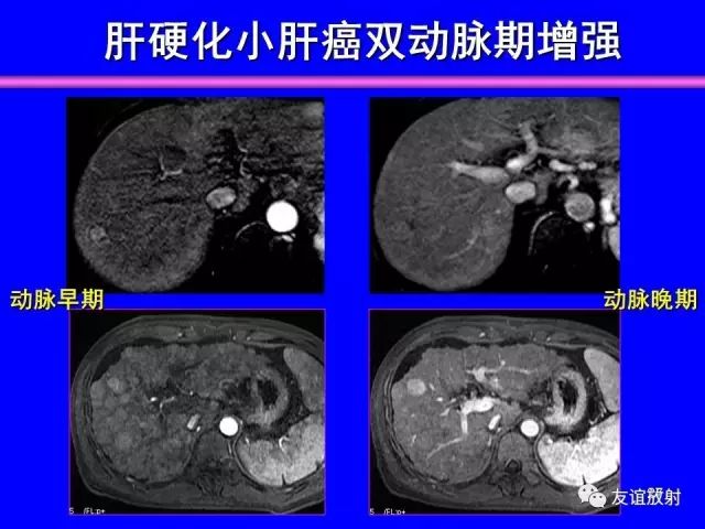 影像PPT - 【PPT】腹部脏器影像解剖及CT、MRI读片原则-27