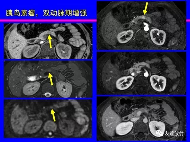影像PPT - 【PPT】腹部脏器影像解剖及CT、MRI读片原则-28