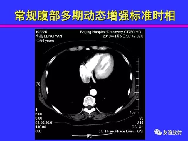 影像PPT - 【PPT】腹部脏器影像解剖及CT、MRI读片原则-33